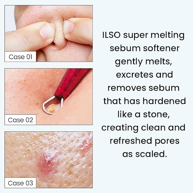 ilso - Super Melting Sebum Softener [150ml]